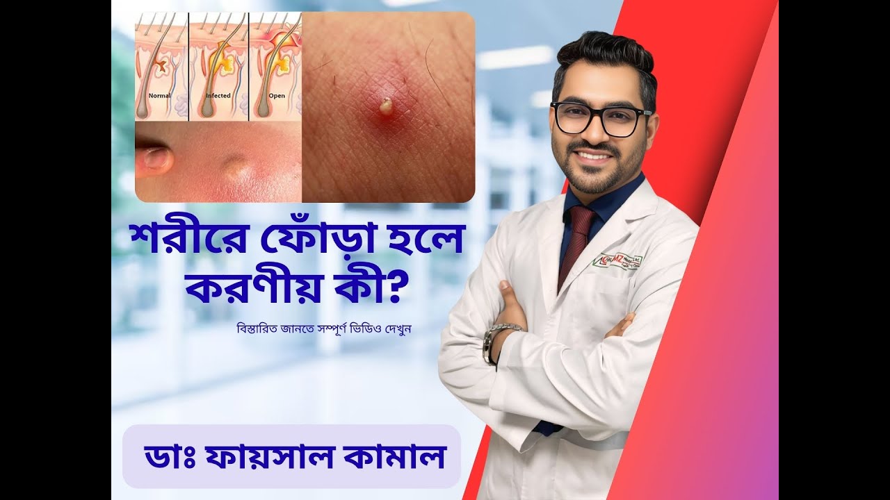 শরীরে ফোঁড়া (Abscess) হলে করণীয় কী?