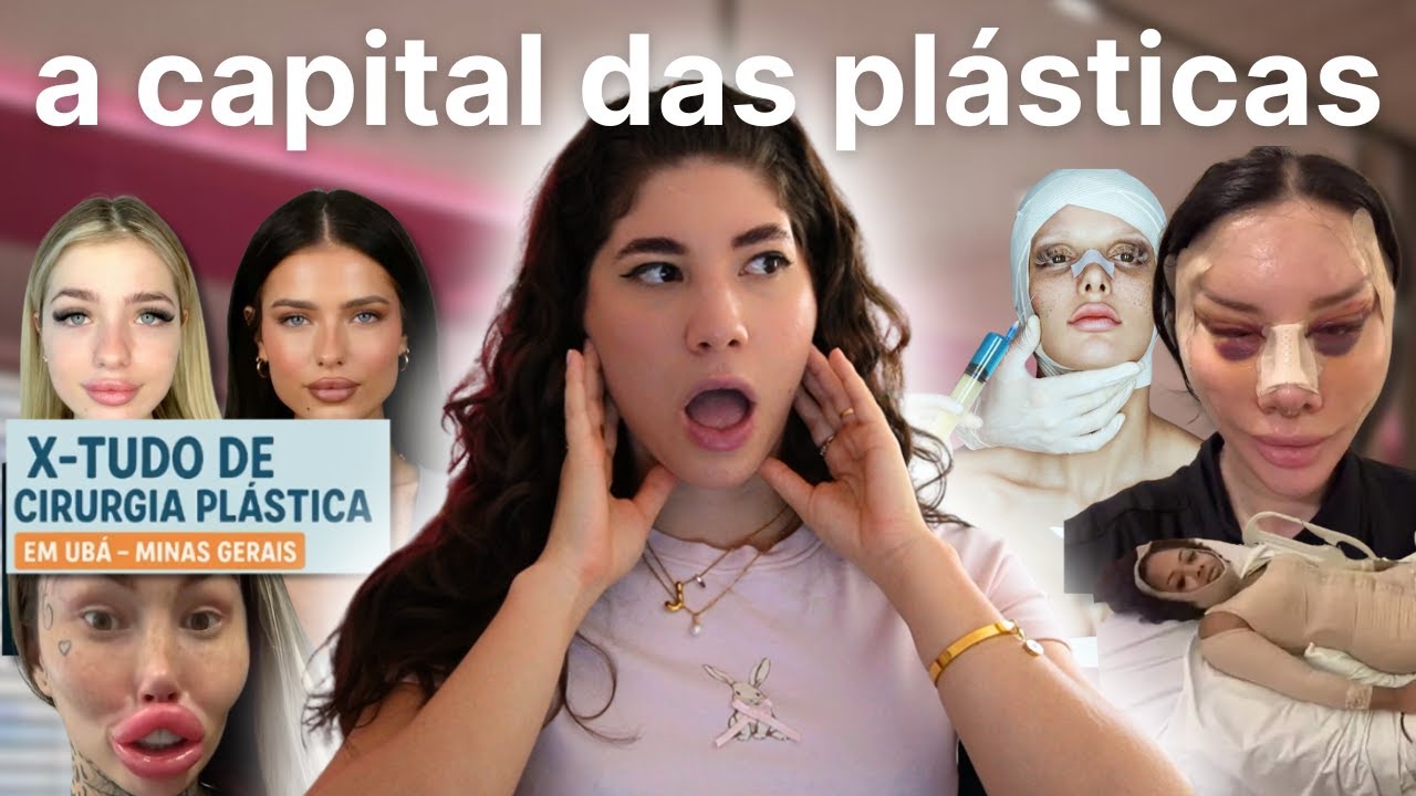 Obcecadas por Beleza: A Verdade por Trás da Cidade que Vive de Cirurgia Plástica