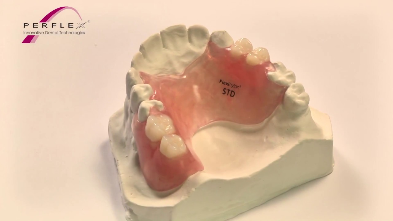 Perflex Flexinylon - adding a new tooth/clasp instructions