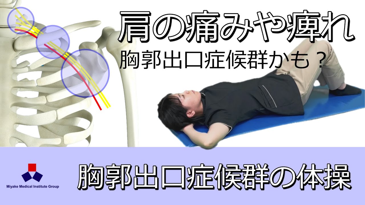胸郭出口症候群の体操