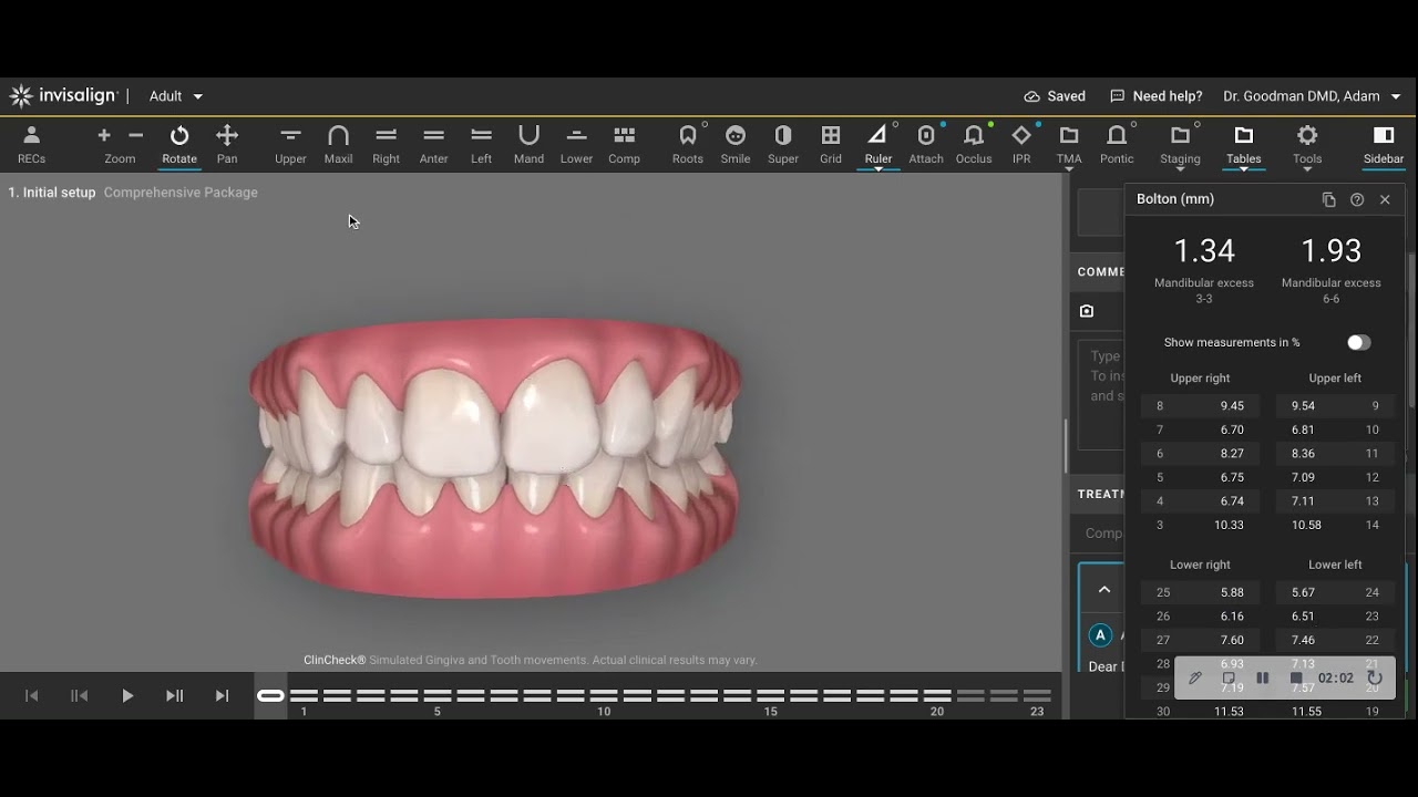 Tip vs. Torque with and Invisalign Clincheck