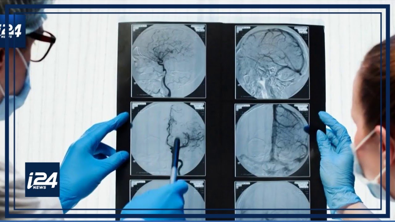 Israeli Alzheimer researchers search for cure