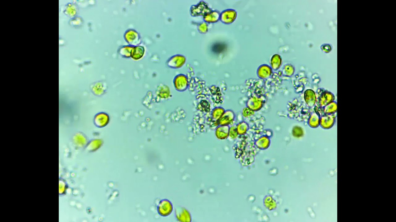 Chlamydomonas reinhartii