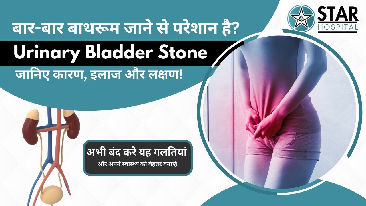 Urinary Bladder Stone in Hindi - Causes, Symptoms, Risks, Preventions, Lecture & Treatment