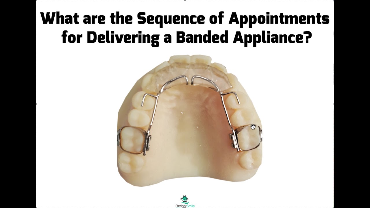 What are the Sequence of Appointments for Delivering a Banded Appliance?
