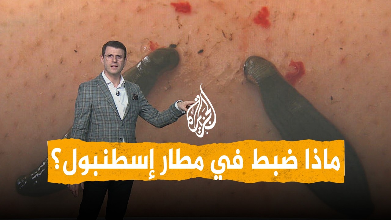 شبكات | مصاصة دماء لاترحم .. ماذا ضبط في مطار إسطنبول؟