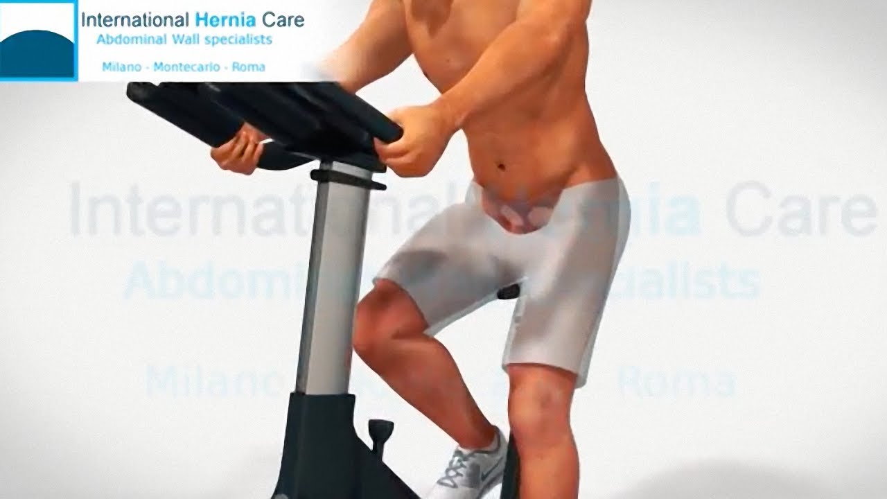 Inguinal hernia | Symptomes