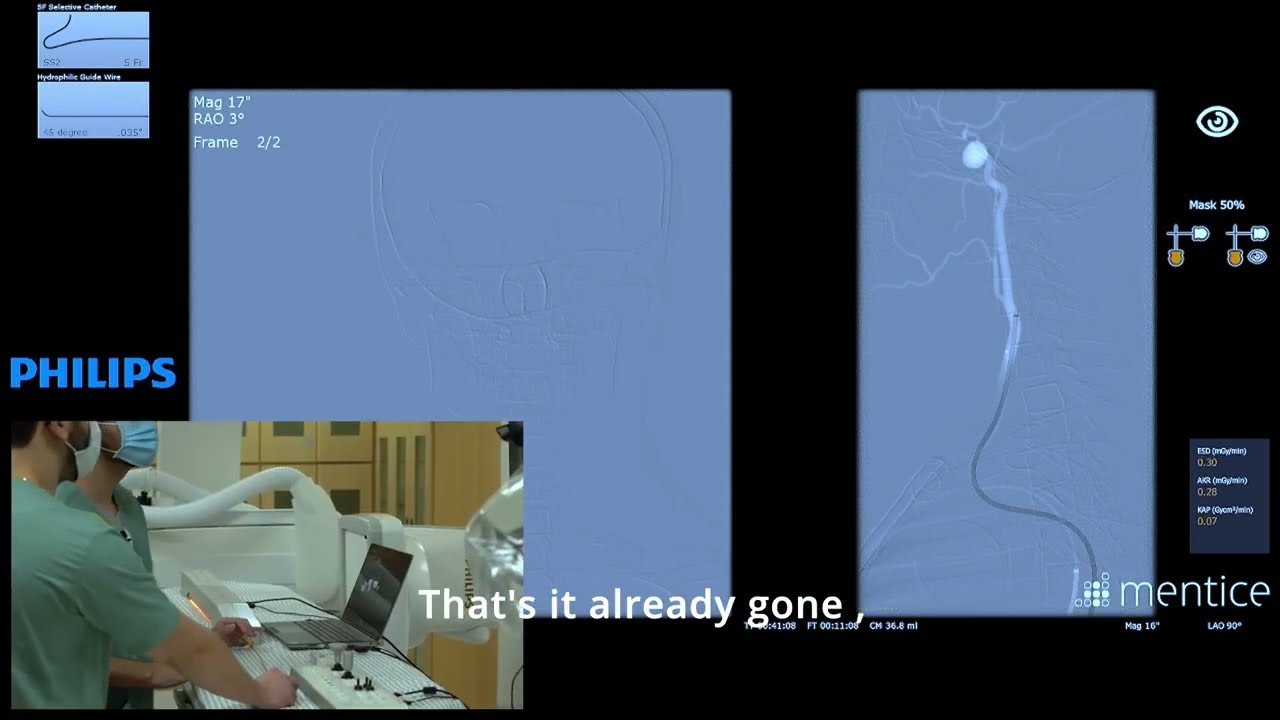Interventional Neuroradiology fellows exposed to advanced techniques on the Mentice virtual patient