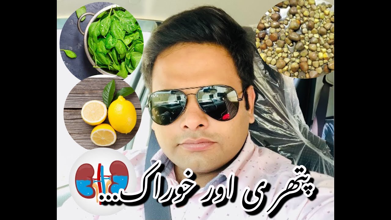 Kidney stones and preventive measures in Diet||گردے کی پتھری اور خوراک میں کیا تعلق ہے ‍‍