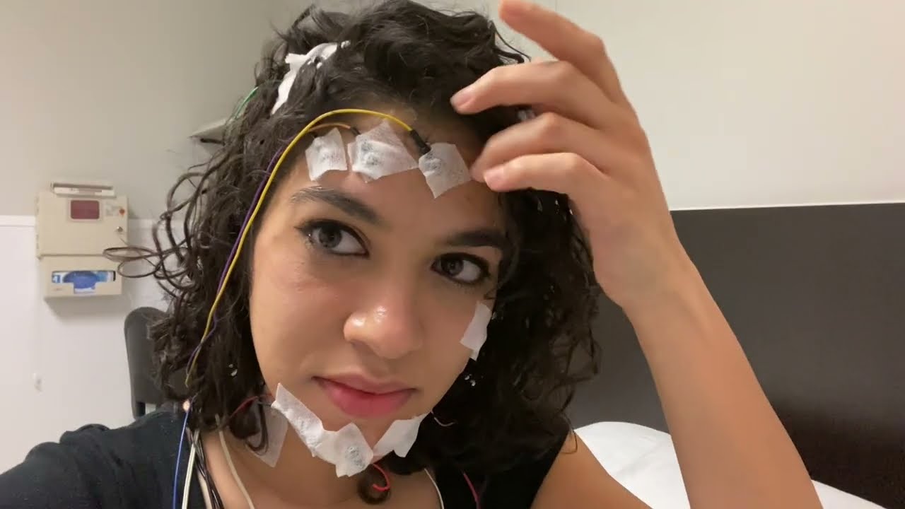 Narcolepsy Sleep Study Vlog Polysomnography and Multiple Sleep Latency Test (MSLT)