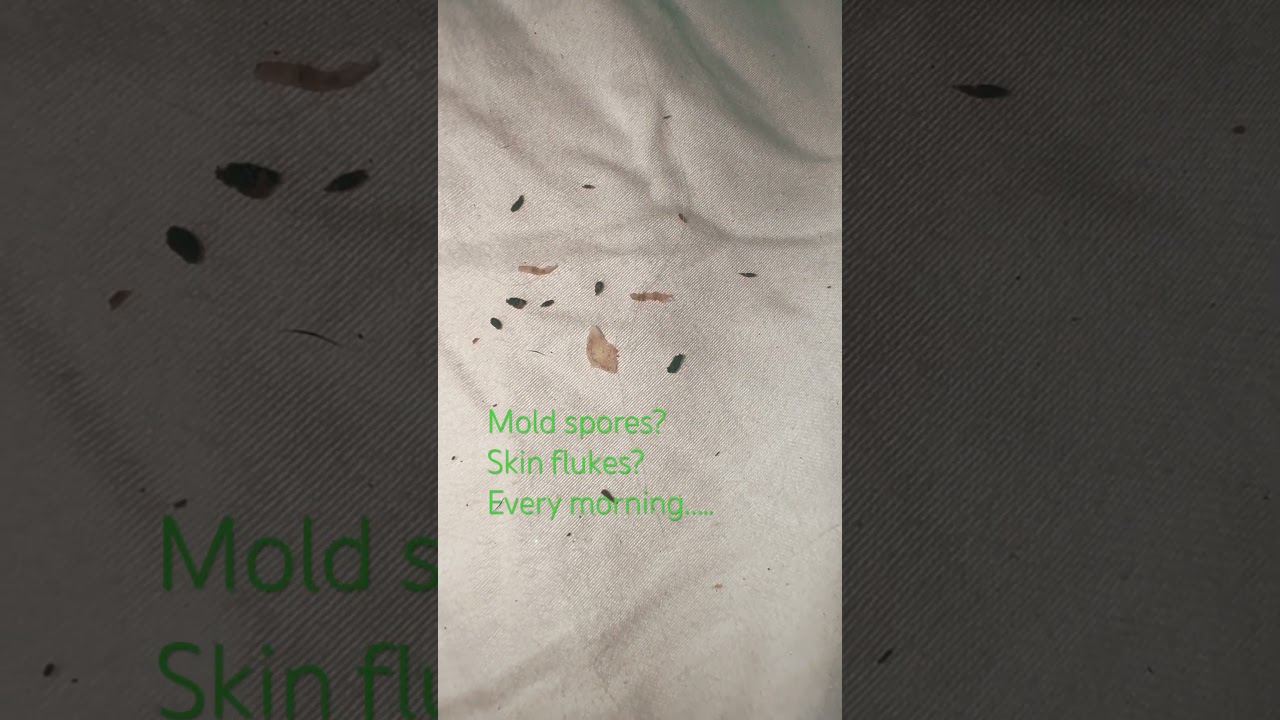 #fungus #spores #mold #skin #flukes #morgellons #myjourney #skin #condition
