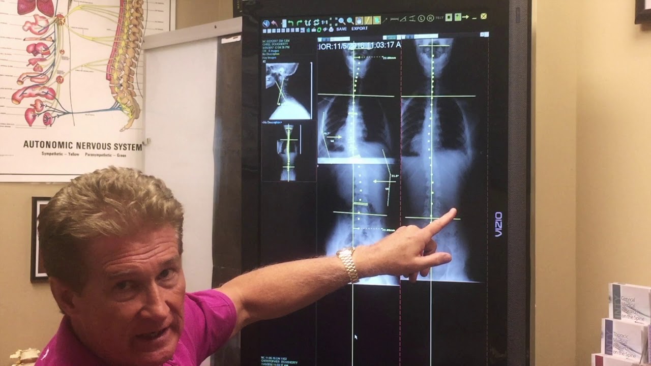 Chiropractor Englewood CO | Proven Correction for Scoliosis