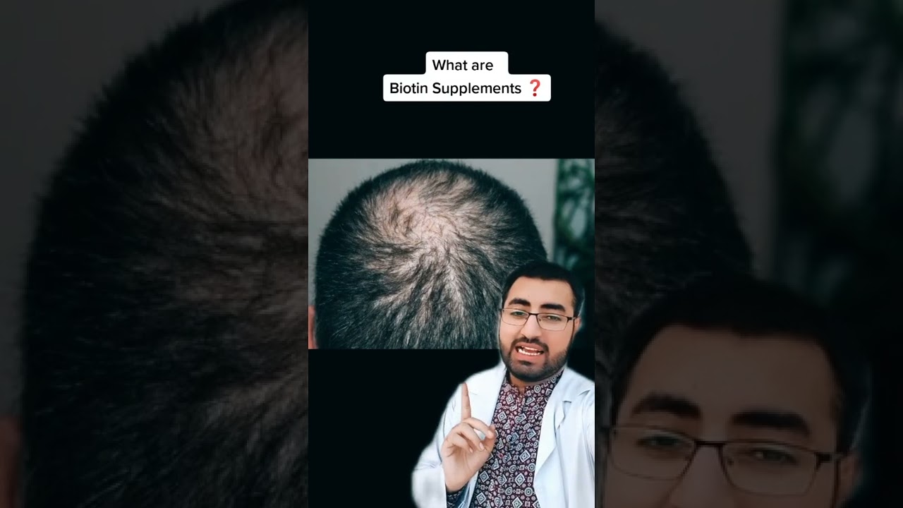 What are Biotin Supplements ❓ Supplements to stop hair loss ❓
