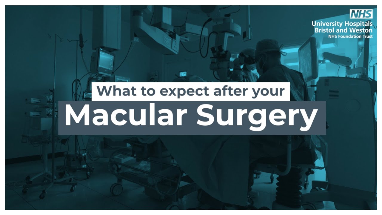 What to expect after macular surgery at Bristol Eye Hospital