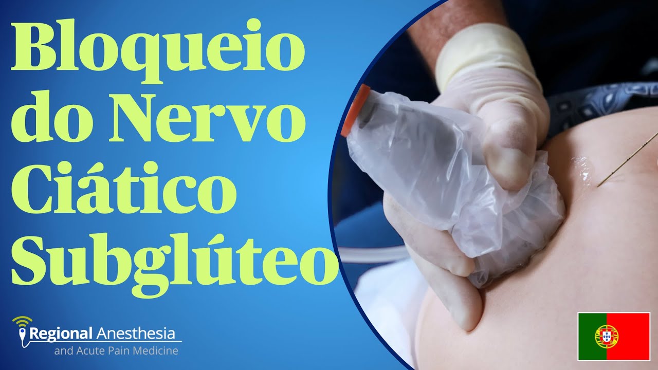 Bloqueio do Nervo Ciático Subglúteo
