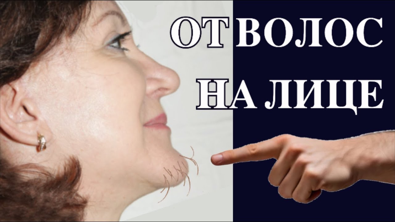 Как я наконец избавилась от волос на лице...
