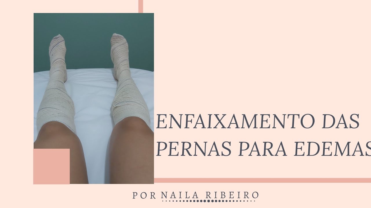 ENFAIXAMENTO DAS PERNAS PARA EDEMAS