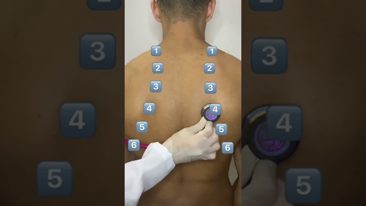 Aprenda a fazer uma Ausculta Pulmonar #shorts
