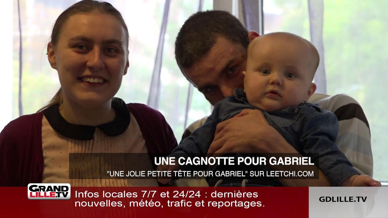 La Brachycéphalie, une maladie qui déforme la tête