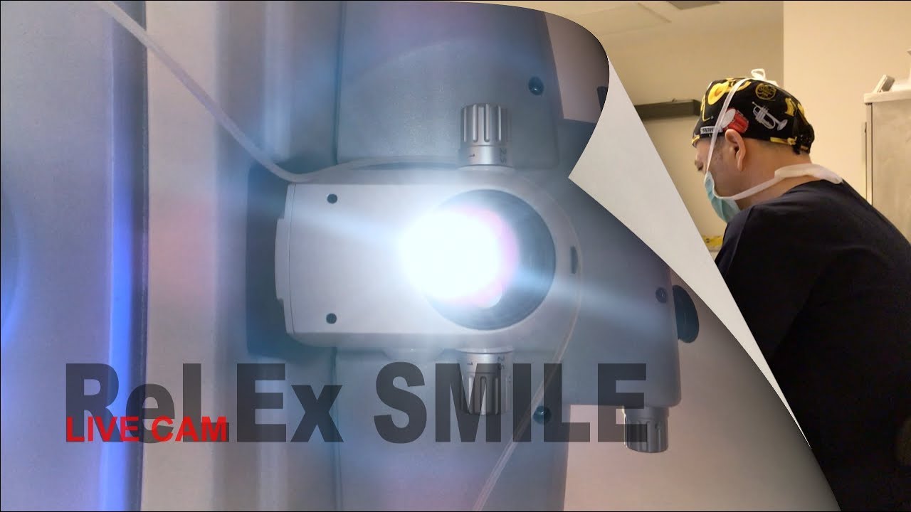 Canlı SMiLE Lazer göz çizdirme deneyimi