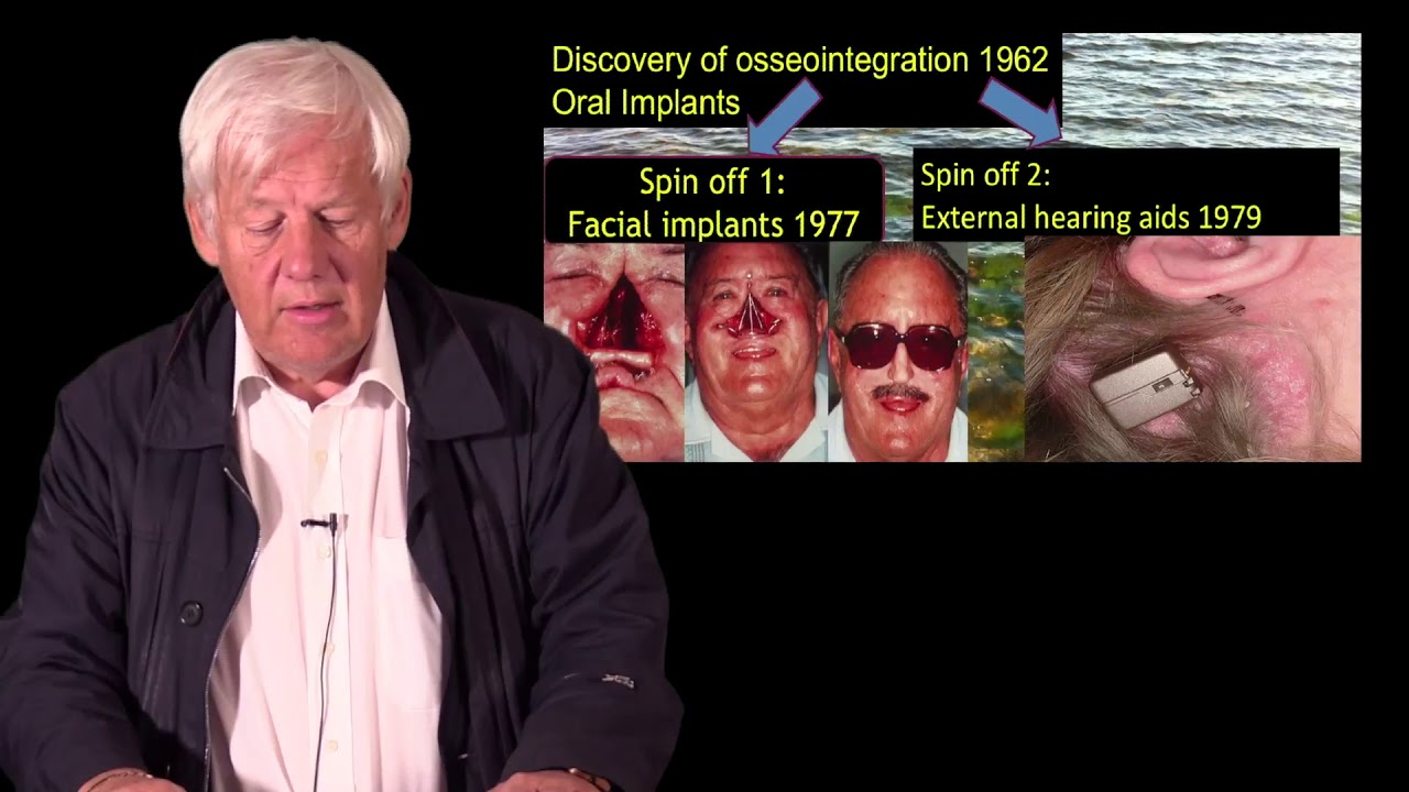 307-00 The Story of Osseointegration and How Implants were Developed by P-I Br&aring;nemark PREVIEW