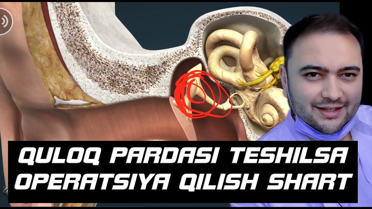 QULOQ PARDASI TESHILSA OPERATSIYA QILISH SHARTMI?