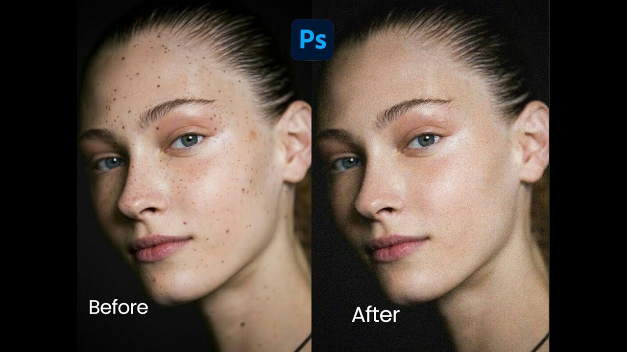How to remove acne/pimple from face in Photoshop 