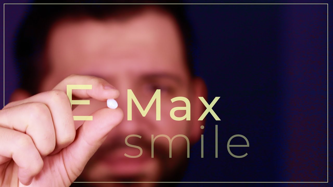 5 motive sa alegi fatetele dentare ceramice EMax