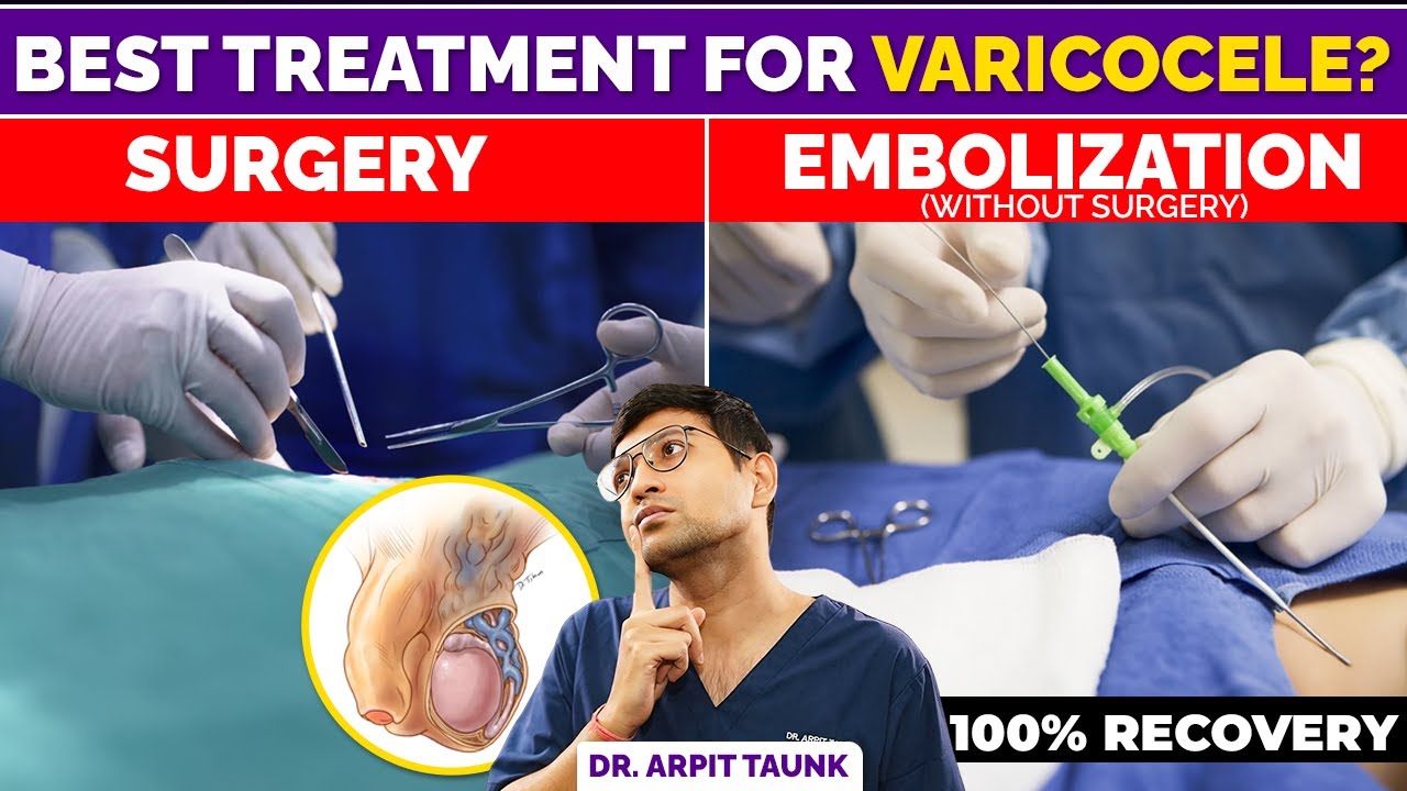 Best Treatment for Varicocele in Hindi | Varicocele Surgery Vs Embolization | Dr. Arpit Taunk