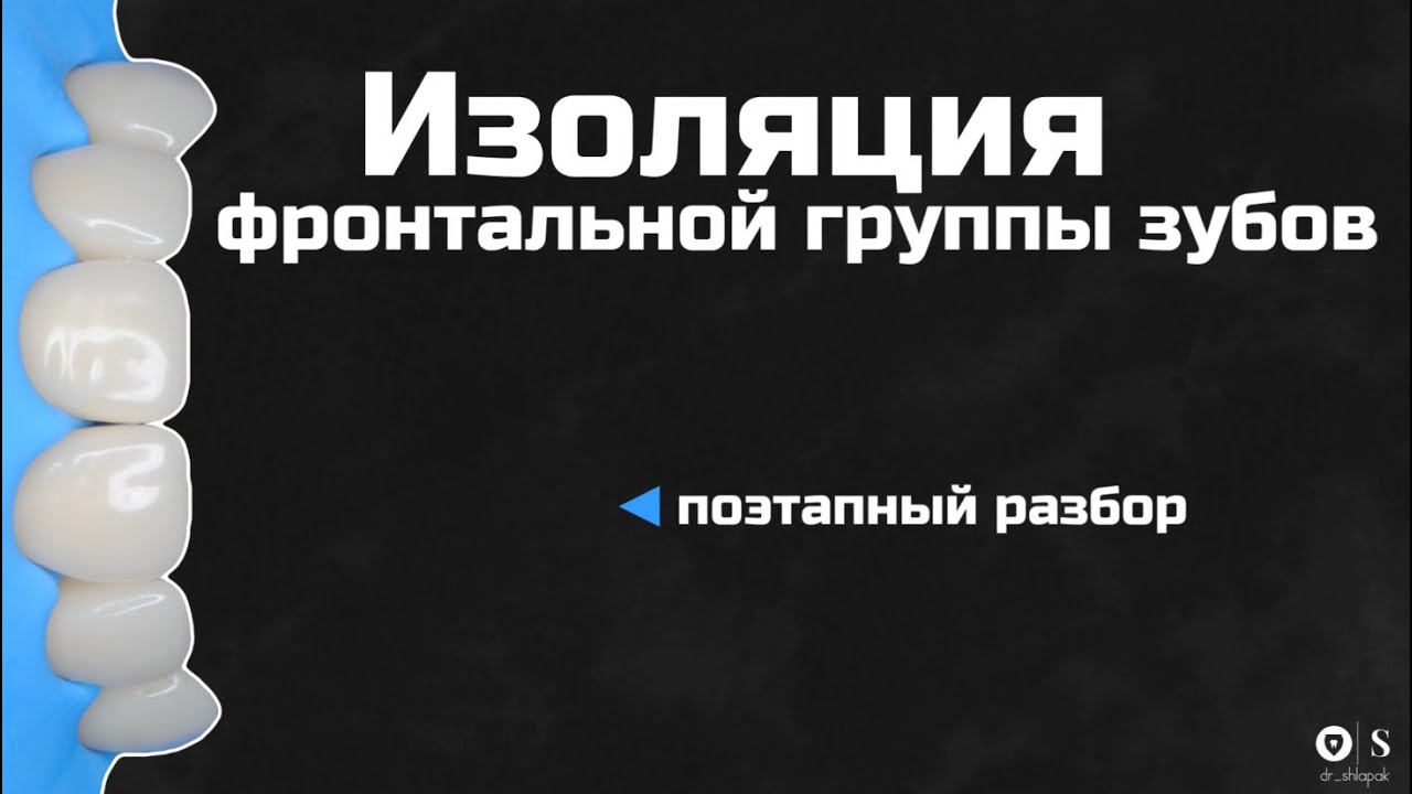 Изоляция фронтальной группы зубов.