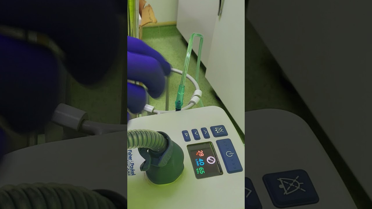 شرح مُبسط عن جهاز (HFNC) High Flow Nasal Cannula  الدكتور احمد عبد الحسين الحسيناوي