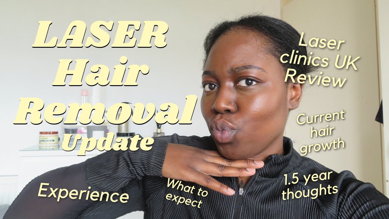 Laser Hair Removal Update-UK Black Girl, 1.5 years in | Hanchronicles