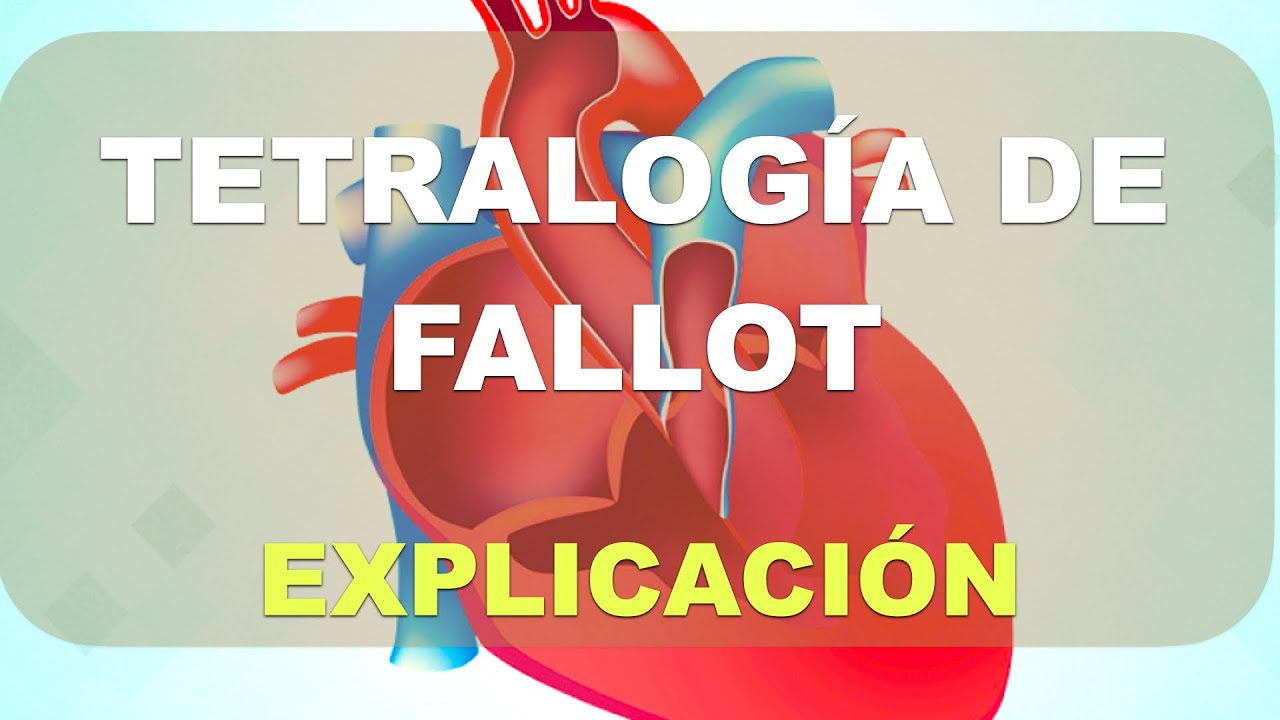 Tetralog&iacute;a de Fallot. Explicaci&oacute;n