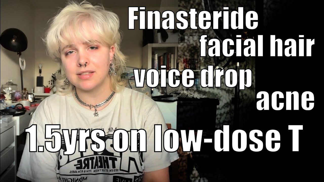 1.5 Years Low-Dose Testosterone Update - FTM Transition Timeline