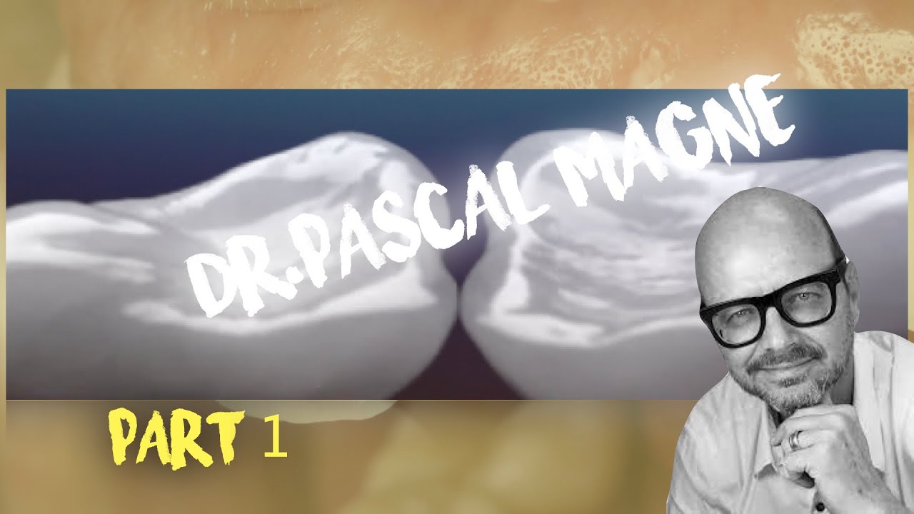 Pascal Magne Part #1