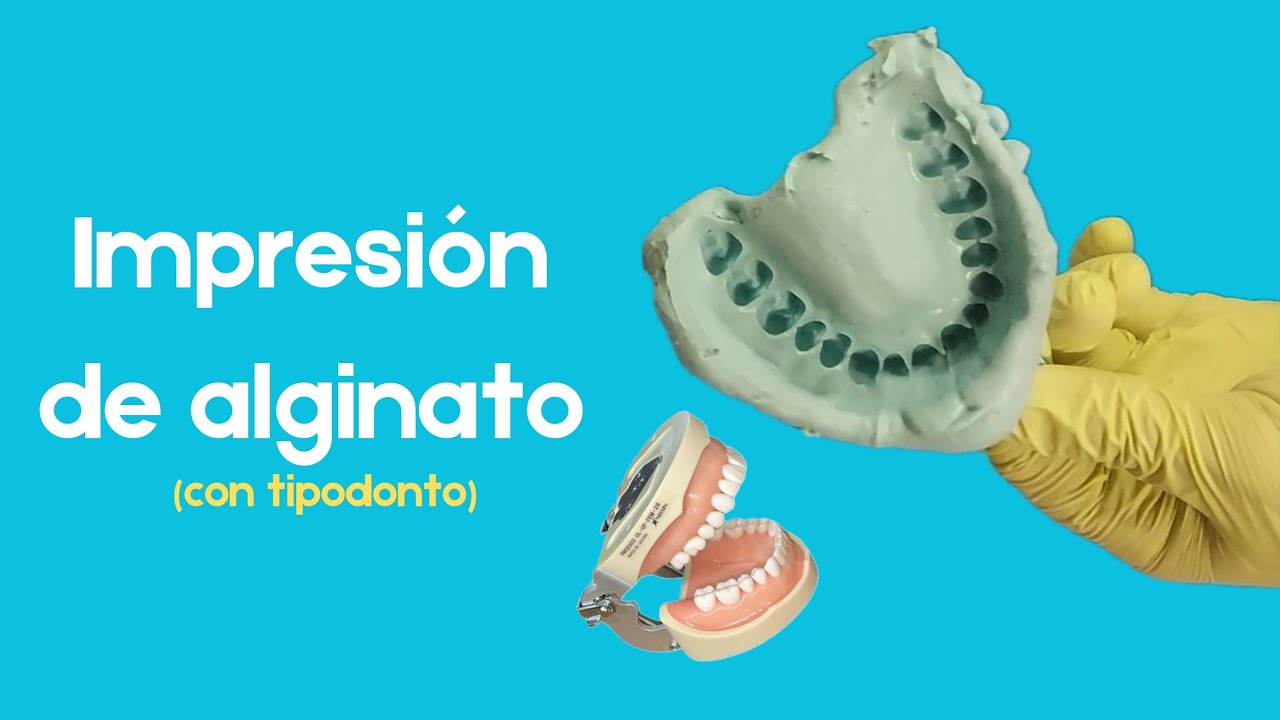impresi&oacute;n de alginato usando tipodonto