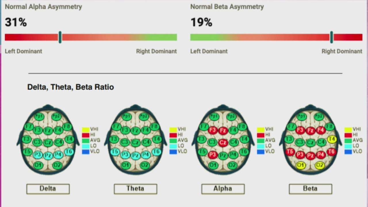 Tennessee Neurofeedback and brain mapping