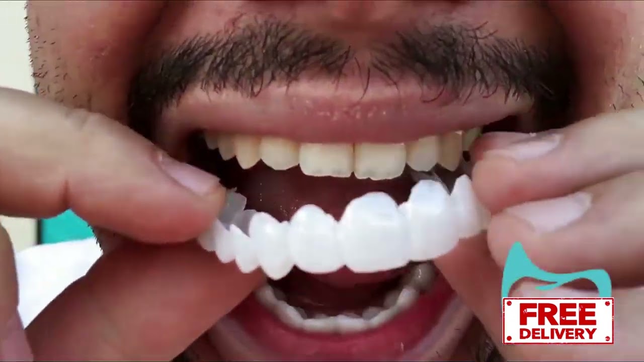 Happy Smile Teeth  | Hollywood Smile
