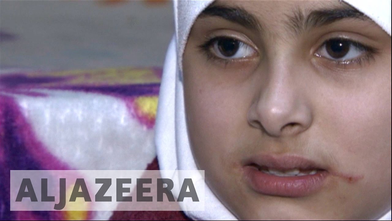 Syrian children undergo trauma and distress - Report