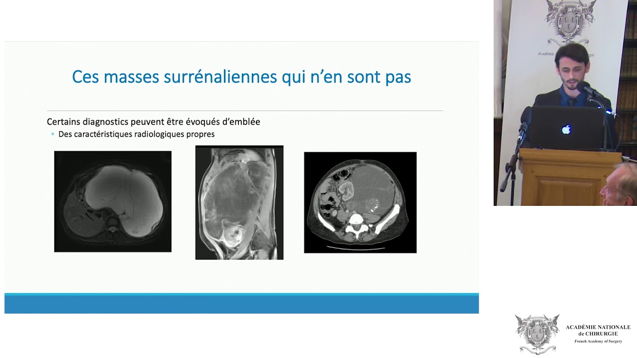 Un incidentalome surrénalien inhabituel : Faut-il opérer ?