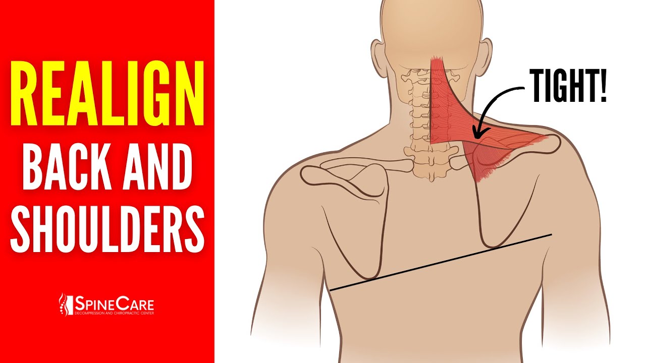 Best Exercises to Realign Your Back and Shoulders