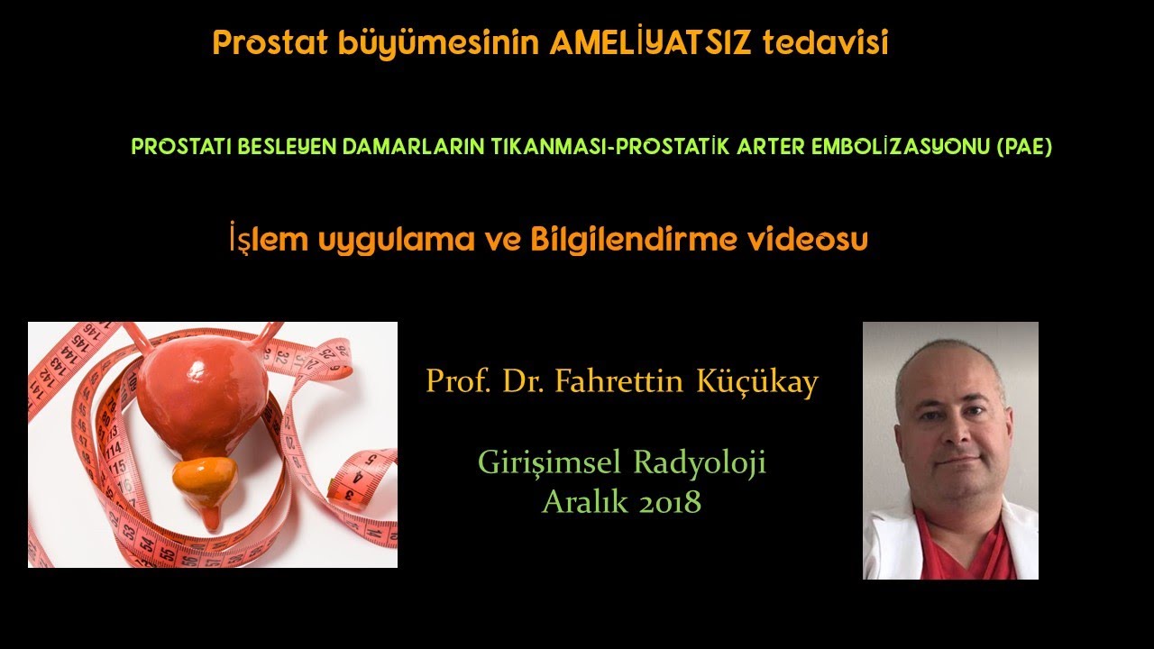 Prostatik Arter Embolizasyonu, Prostat büyümesi