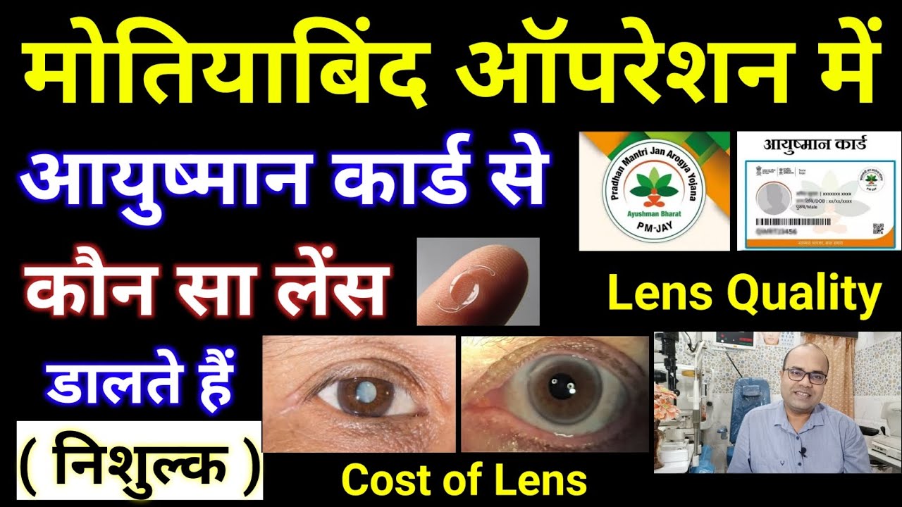 आयुष्मान कार्ड से मोतियाबिंद ऑपरेशन में कौन सा लेंस डालते हैं निशुल्क | Lens Quality | Cost Of Lens