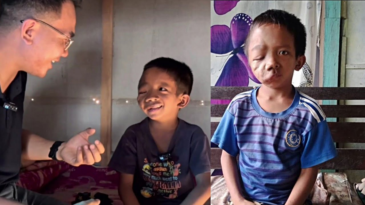 Stroke avangin a hmai a sawi a, a khawhmuh thlengin a fiah tawh lo | A puala thilpek hlanna
