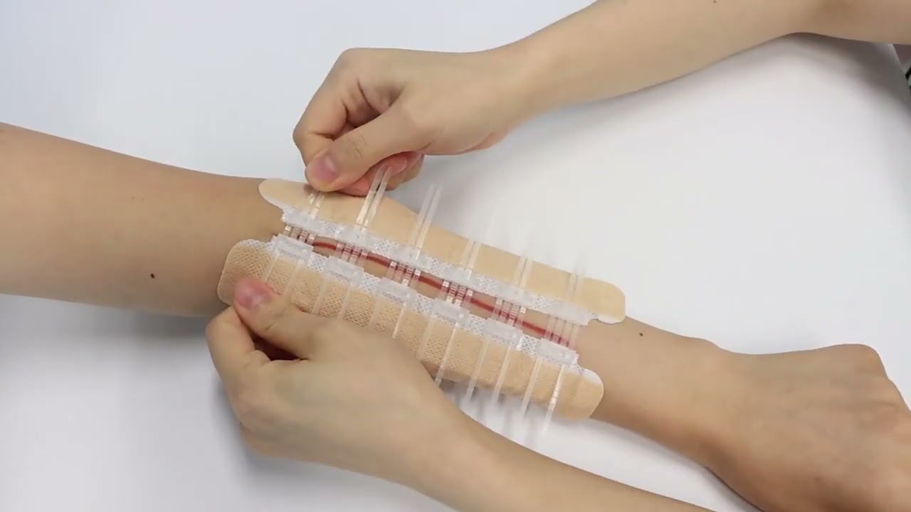 6-Buckle Skin Closure System - How to Use It Like a Doctor (Complete Tutorial)#WoundClosure#FirstAid