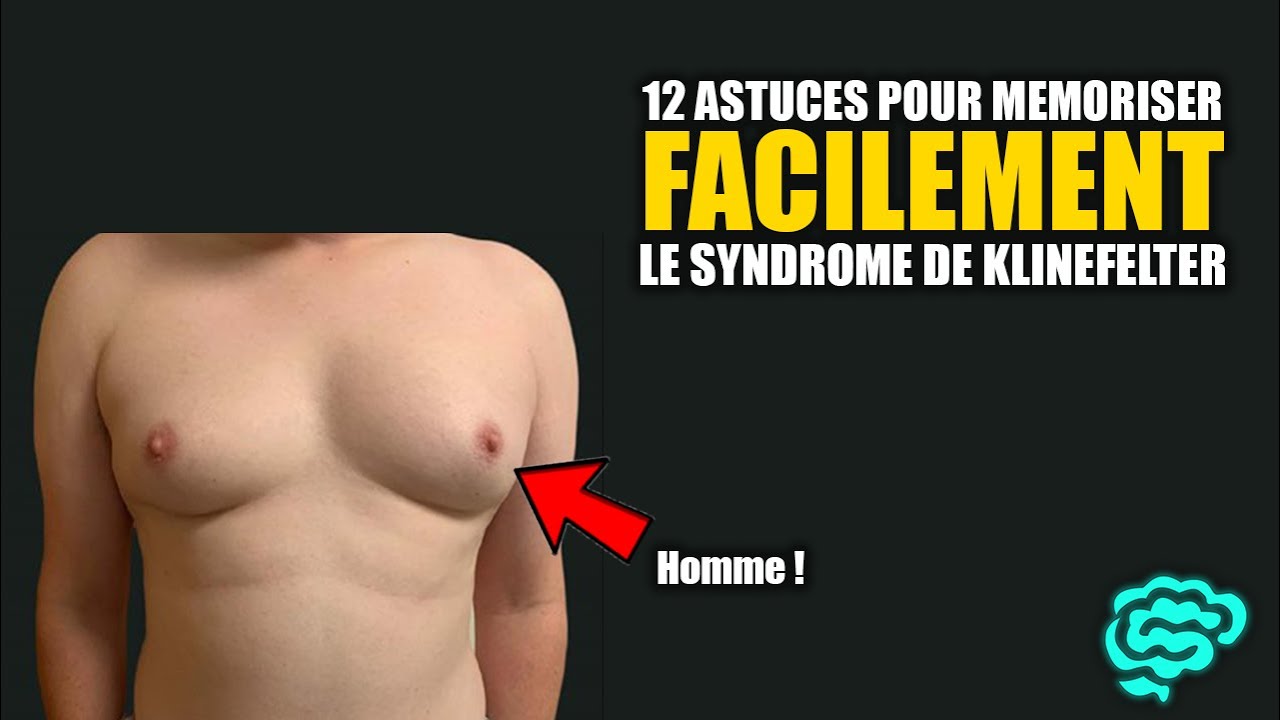 🔴 Klinefelter Expliqué Très Clairement par Dr Astuce