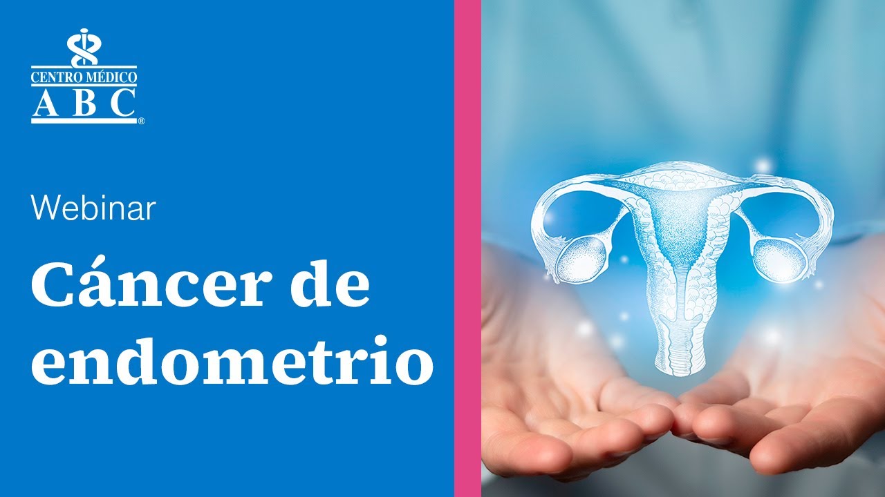 Webinar: cáncer de endometrio