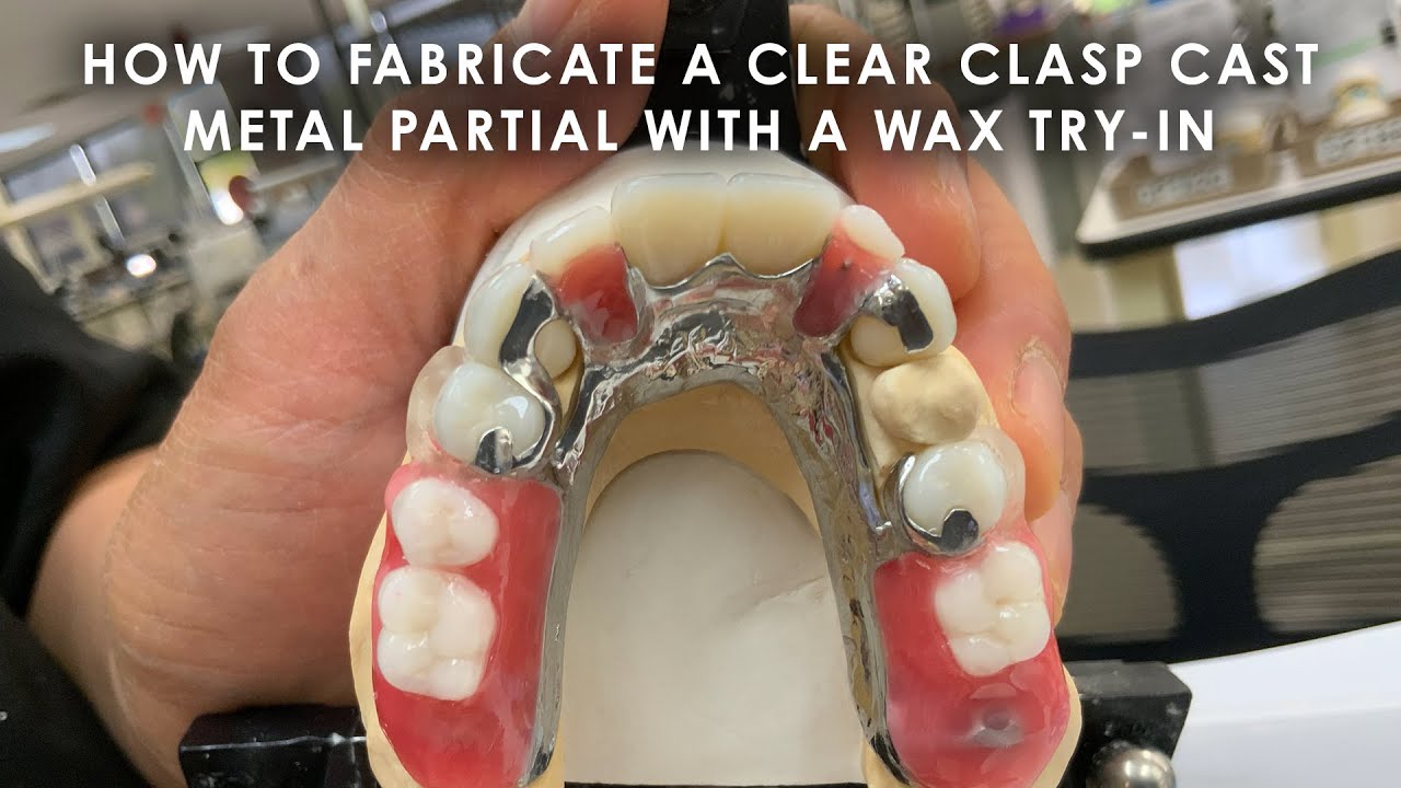 How to fabricate a Clear Clasp Cast Metal Partial with a Wax Try-In