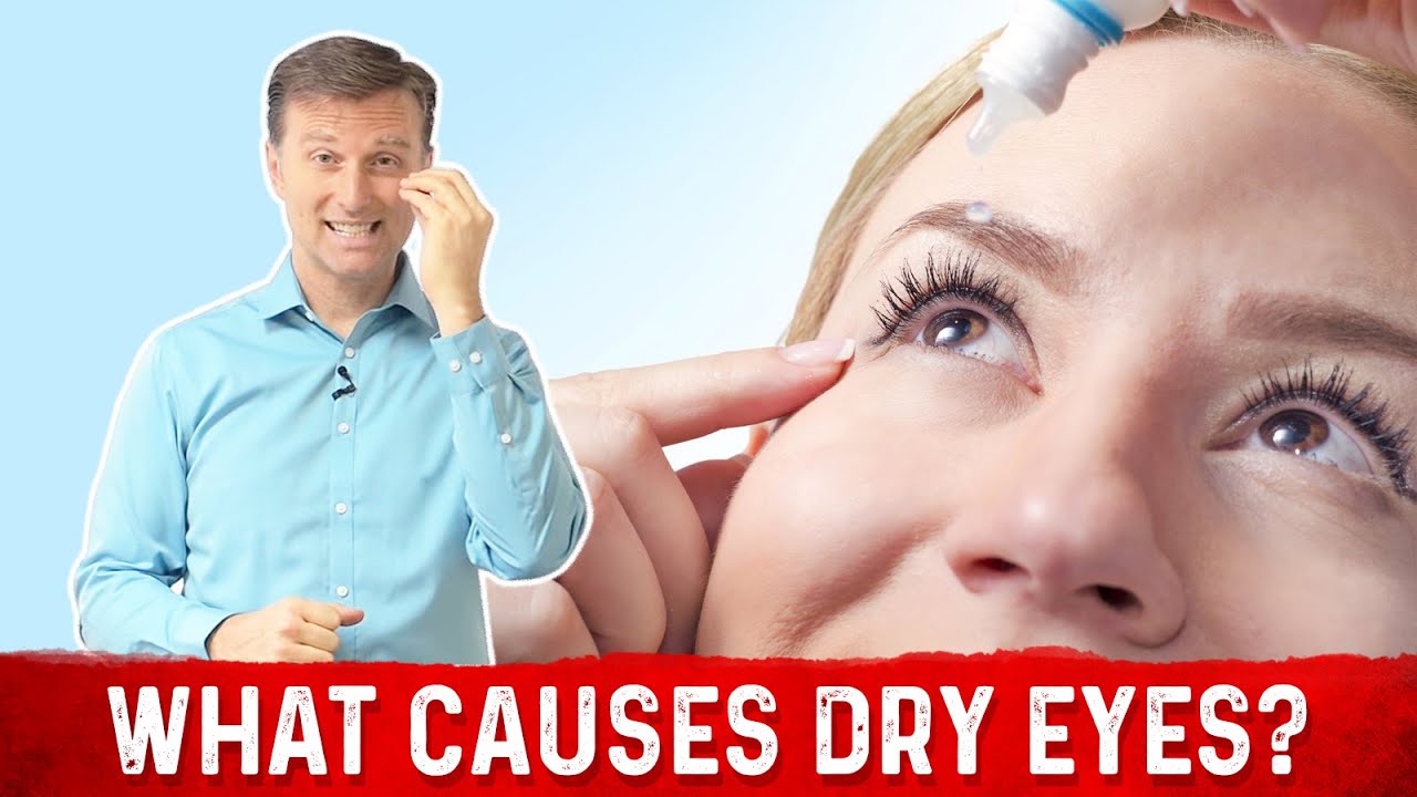 Vitamin A Deficiency &ndash; Causes of Dry Eyes Explained by Dr. Berg