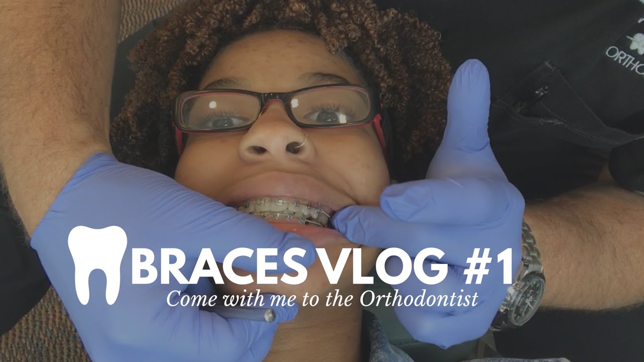 Trapezoid? Triangle? Getting My Braces Adjusted| Braces Vlog #1